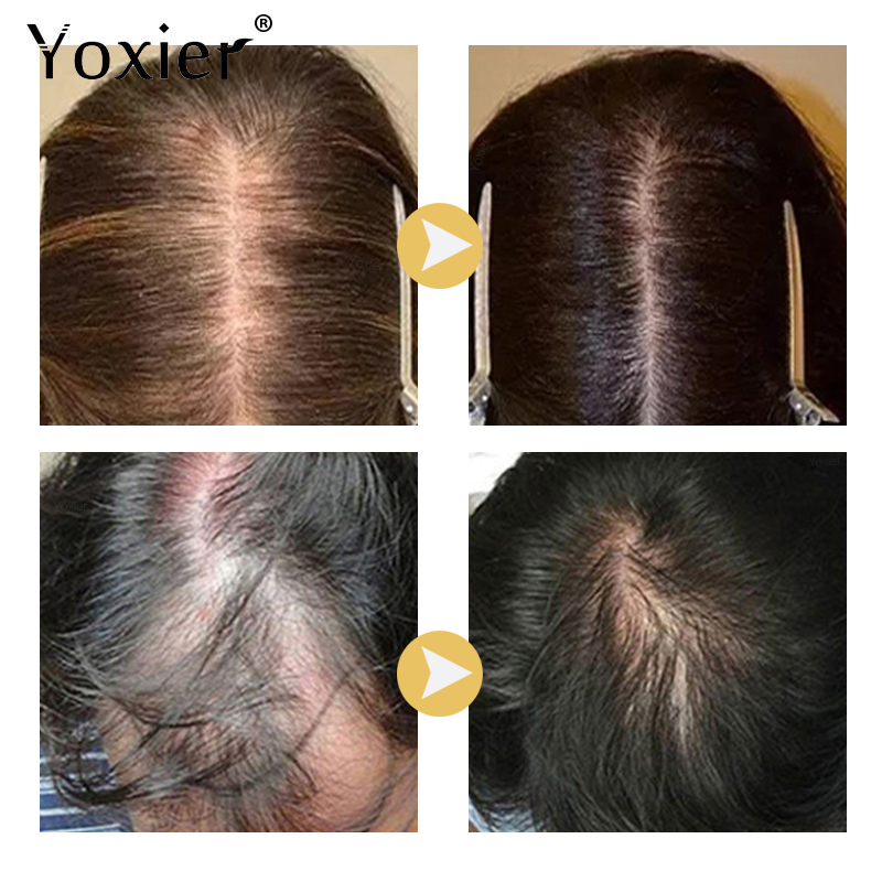 Siero per la crescita intensa  - Hair Care Hair Serum recensione e prezzo