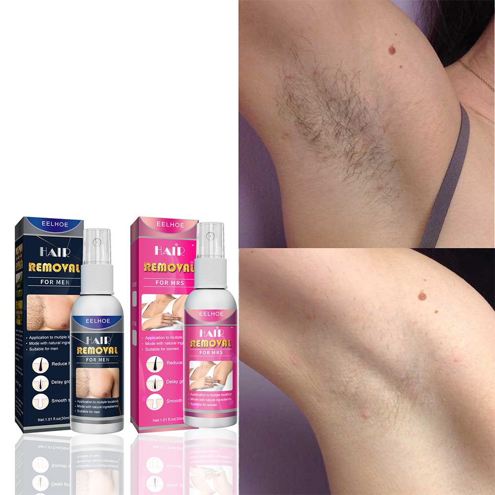 1/2PCS Super Naturale Indolore - Hair Care China recensione e prezzo